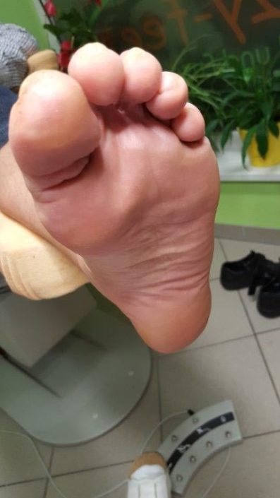 Crazy-feet