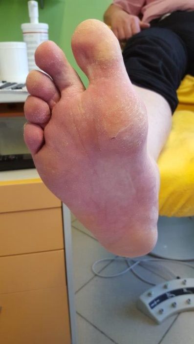 Crazy-feet